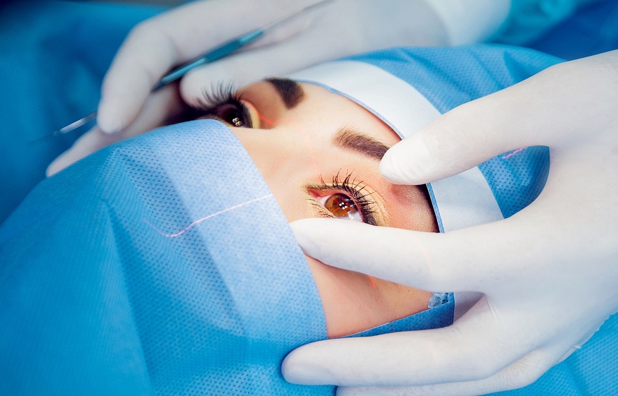 Cataract Surgeons